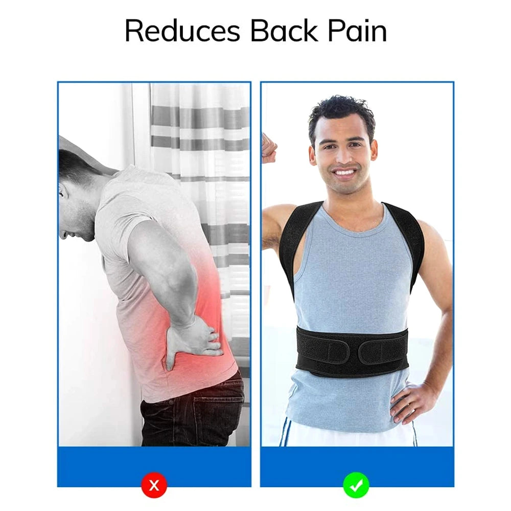 Back & Shoulder Posture Corrector – Adjustable Support Brace for Men & Women