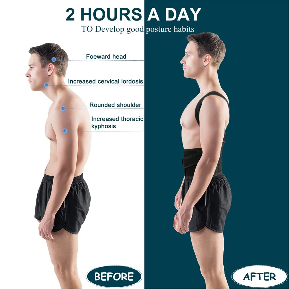 Back & Shoulder Posture Corrector – Adjustable Support Brace for Men & Women